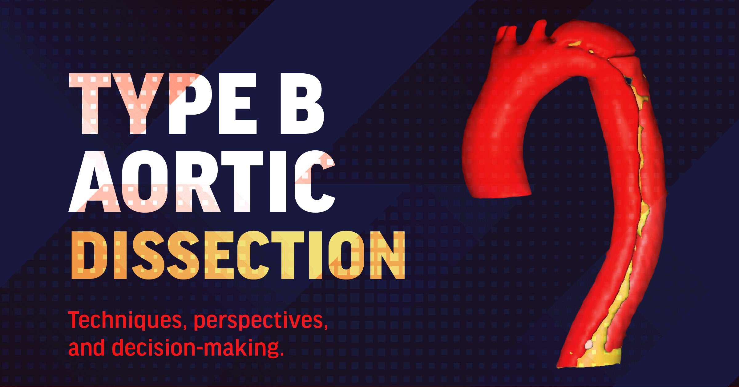 Type B Aortic Dissection: Perspectives, Techniques, And Decision-Making ...